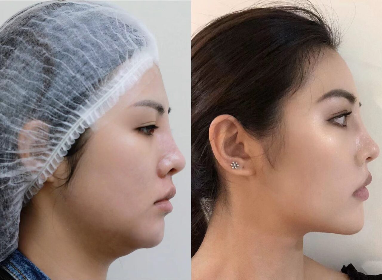 Profound® 67 Degrees Cosmetic Clinic